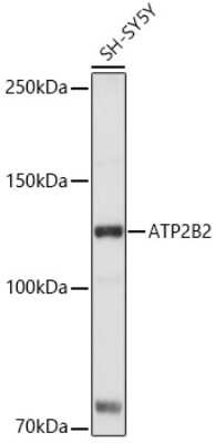 Western Blot: PMCA2 Antibody [NBP2-95221] - Western blot analysis of extracts of SH-SY5Y cells, using PMCA2 antibody (NBP2-95221) at 1:1000 dilution. Secondary antibody: HRP Goat Anti-Rabbit IgG (H+L) at 1:10000 dilution. Lysates/proteins: 25ug per lane. Blocking buffer: 3% nonfat dry milk in TBST. Detection: ECL Basic Kit. Exposure time: 1s.